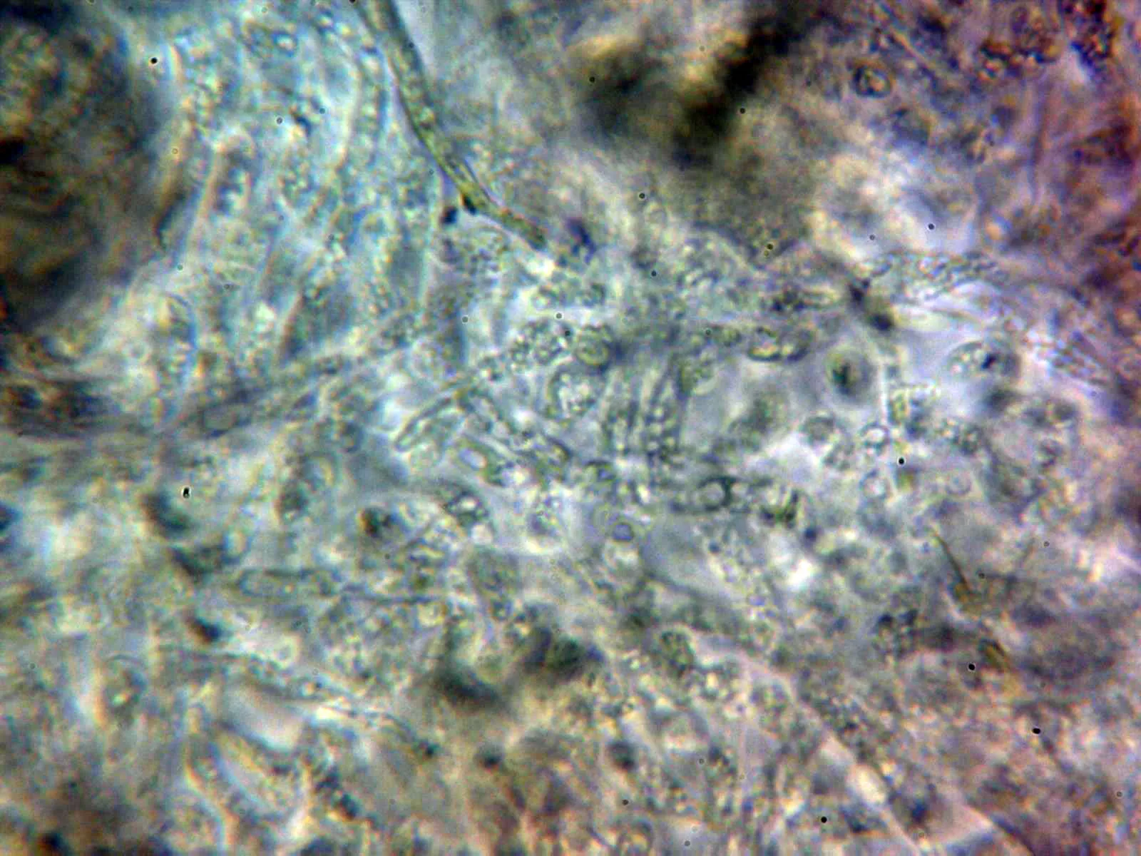Microscopía de Rhodocollybia maculata - 11 - Suprapellis 1